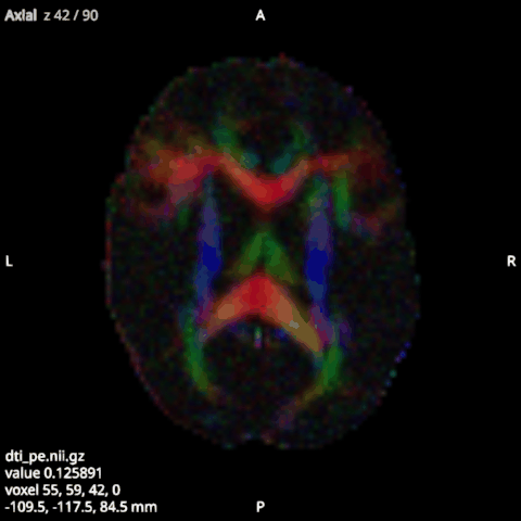 The principal eigenvector as a DTI colour map, weighted by FA