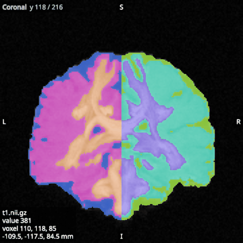Tissue labels (CSF, grey and white matter of each hemisphere) over the T1, shown as labels in the built-in colours