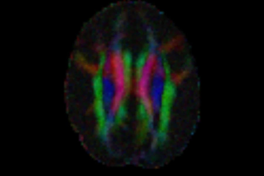 Axial slice of the simulated brain coloured by the principal diffusion direction and brighter where FA is high: the corpus callosum red, the corticospinal tracts blue, bundles running front to back green