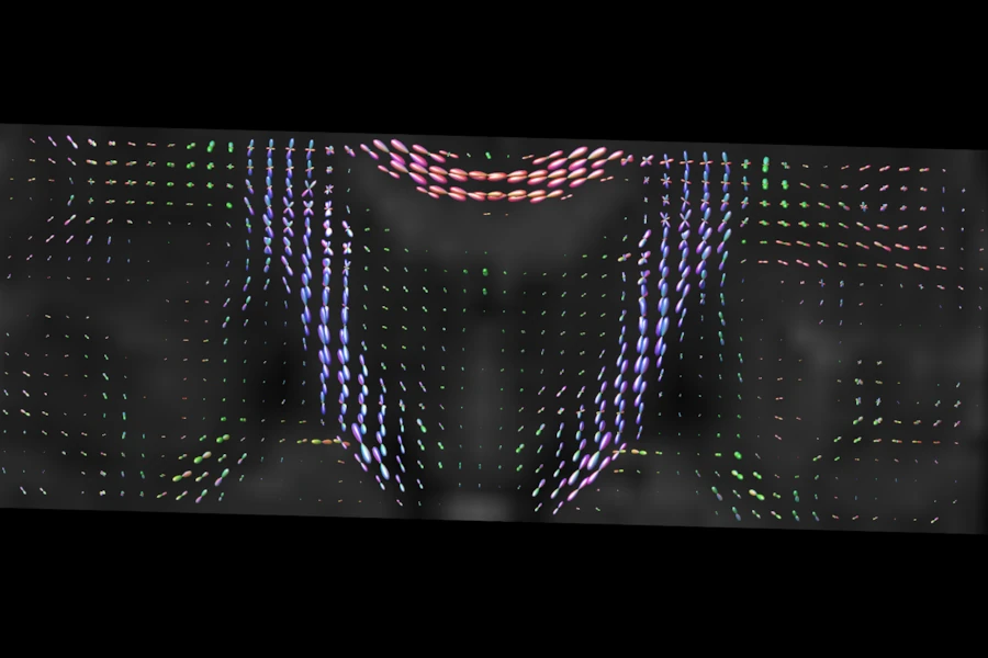 White matter FOD glyphs from MSMT-CSD on a coronal slice of the CFIN brain, over its mean b=0 image