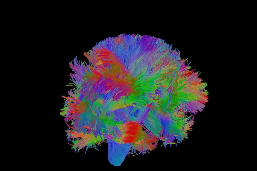 Whole-brain streamlines of the simulated brain drawn as lit tubes in 3D, seen from the front and slightly from the side, coloured by direction