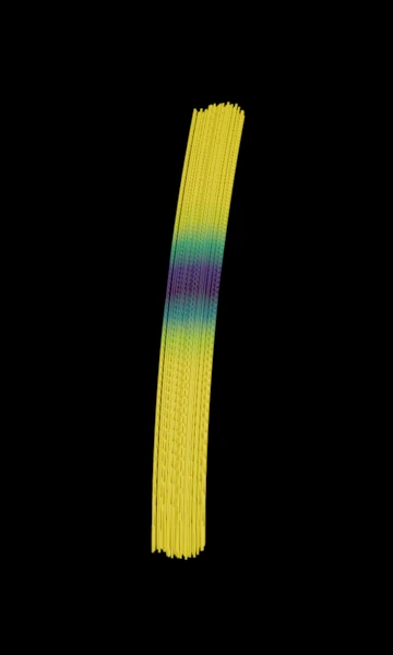 A synthetic bundle drawn as tubes in 3D, coloured by its FA profile: yellow where FA is high, purple at the lesion halfway along