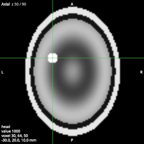 Axial view of a synthetic head with the crosshair and the readout of the value under it
