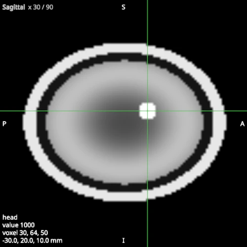 Sagittal view of the same head with the crosshair