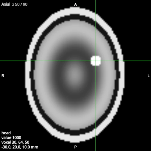 The axial view in the radiological convention, the subject's right on the screen's left