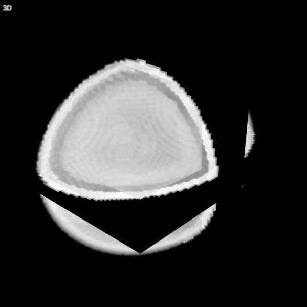 3D view of a synthetic head: three slices and a volume rendering, from the default position