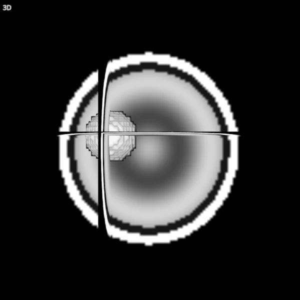 The three slices and the blob's surface alone, seen from the front