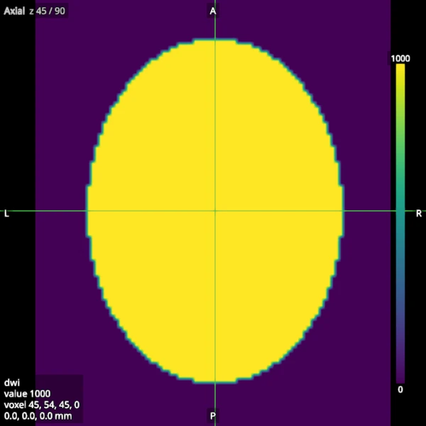 Axial slice of the first volume of a synthetic diffusion series in a viridis colormap, with a colour bar