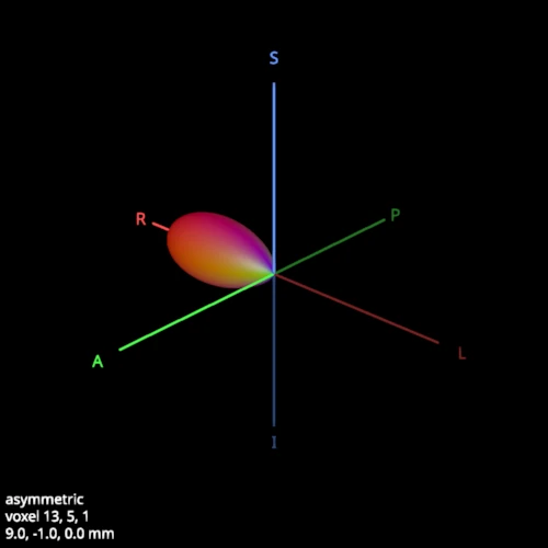 One asymmetric FOD drawn large, its single lobe pointing to the subject's right