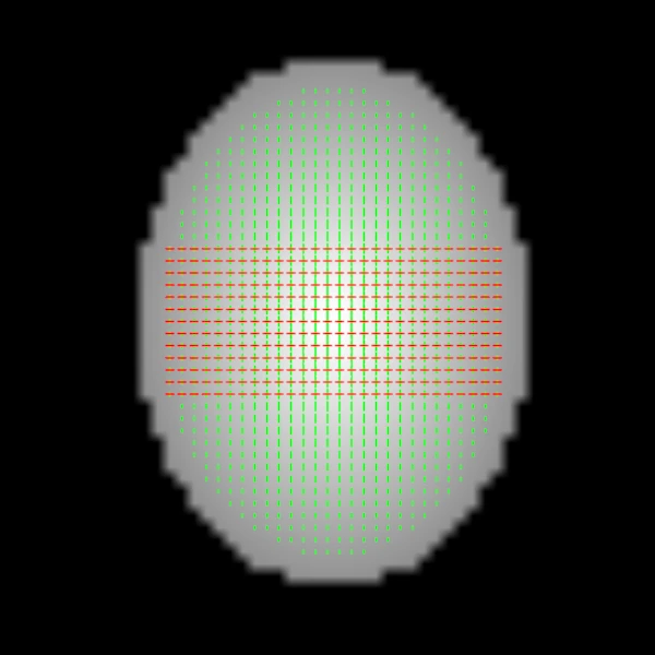 Synthetic FOD peaks as lines on an axial slice of a head, their lengths set by amplitude, two crossing in a band through the middle
