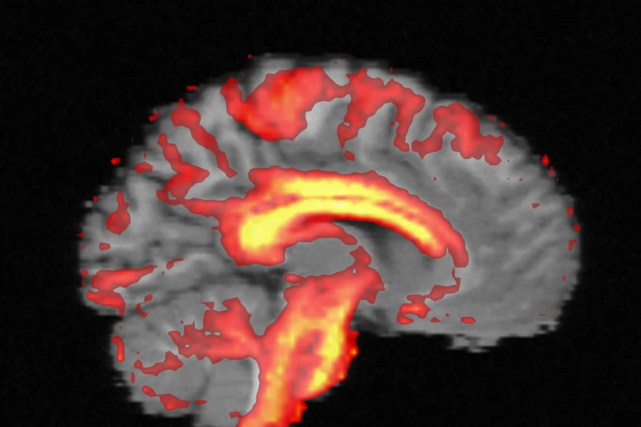 Sagittal slice of the simulated brain: the T1-like image with FA over it, brightest in the corpus callosum and the brainstem