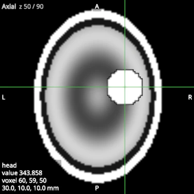 Axial view of a synthetic head with a blob, saved on its own
