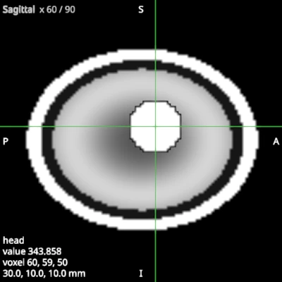 Sagittal view of the same head, saved on its own