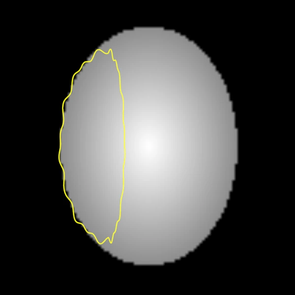 Axial slice of a synthetic head with the line where the slice cuts the surface