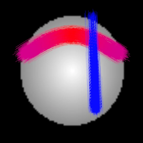Coronal view of the same bundles in a slab
