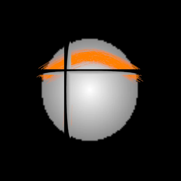 A subset of the same bundles in the 3D view, in one orange colour
