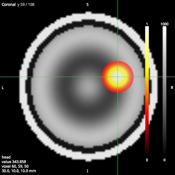 Coronal slice of the same head and blob, with colour bars