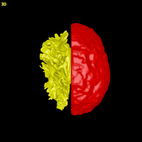 The left white surface and the right pial surface in the 3D view, seen from above
