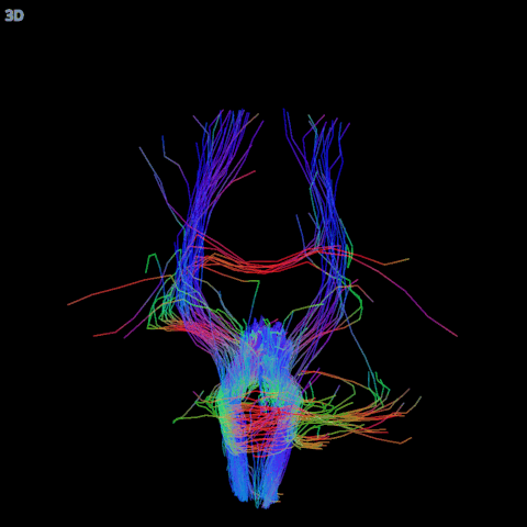 The streamlines that pass through a sphere of radius 8 mm in the brainstem, seen from the front