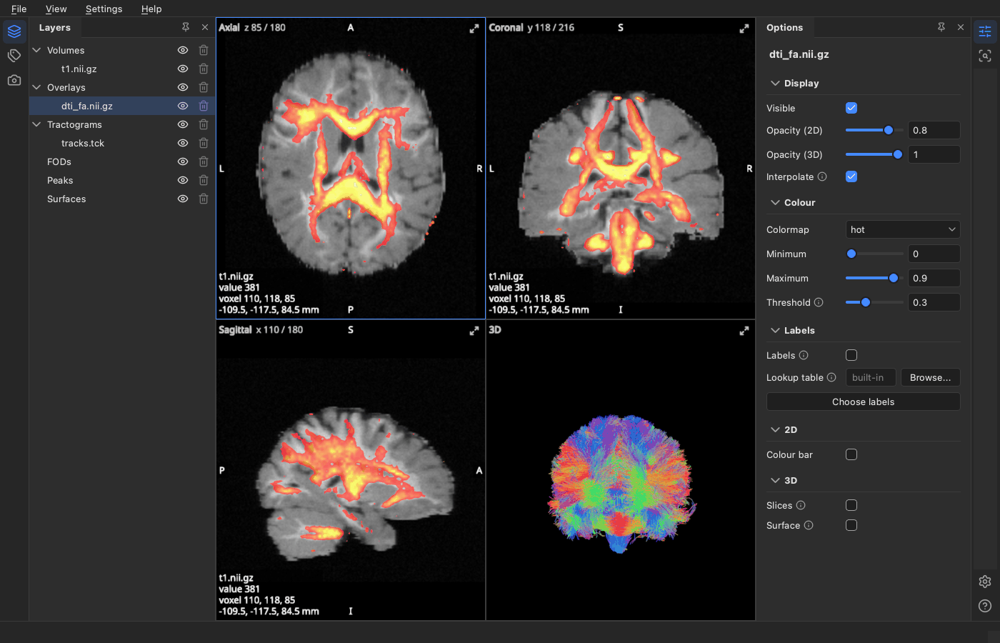 The viewer's window: Layers on the left, the four views in the middle, Options on the right