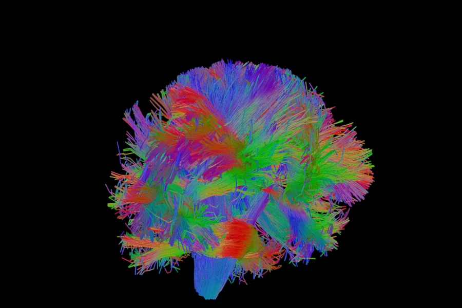 Whole-brain streamlines drawn as lit tubes in 3D, seen from the front, coloured by direction